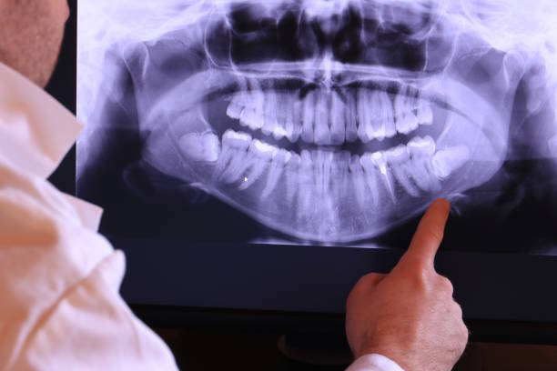 Best Emergency Dentist for Knocked-Out Tooth in Brockport, NY