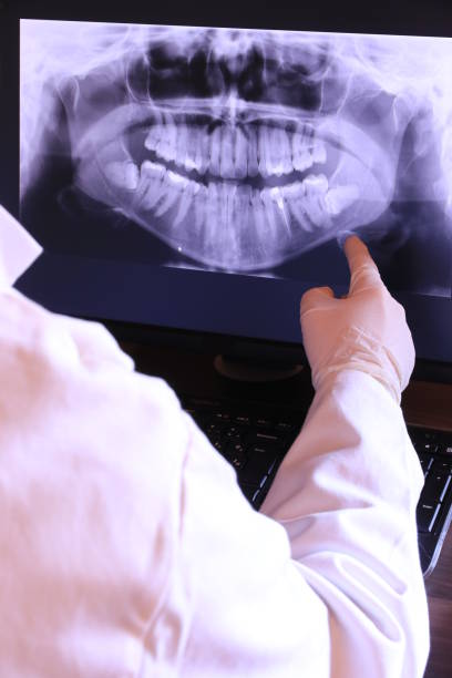 Best Emergency Dentist for Lost Fillings or Crowns in Brockport, NY